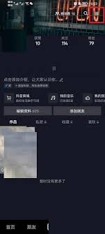 如何恢复抖音聊天记录