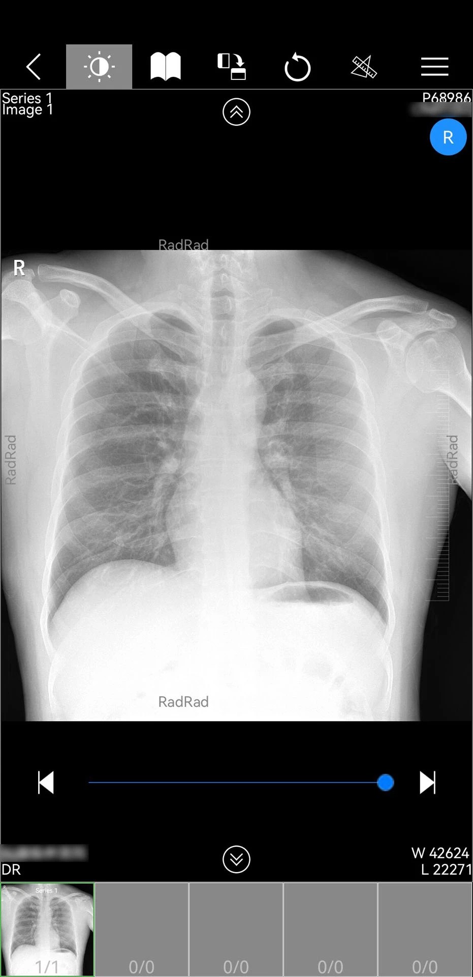 微影医生纯净版