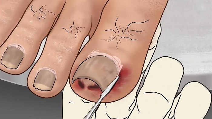 修脚足疔模拟器中文版