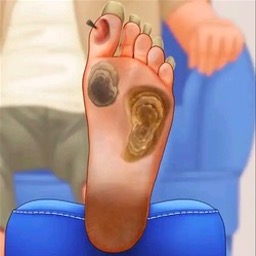 修脚足疔模拟器付费版