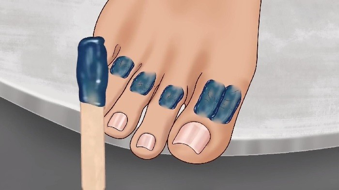 修脚足疔模拟器正版