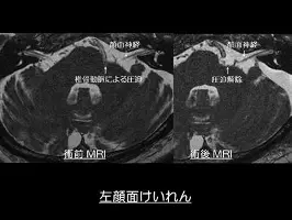 时空猎人觉醒困难宝藏本怎么刷